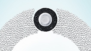 Darstellung des einzigartigen ringförmigen Vorfilters der SenSura Mio-Beutel