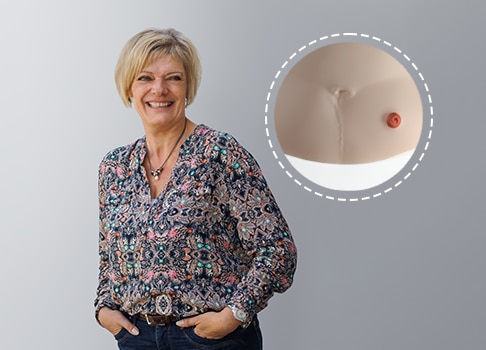 Margrit, SenSura® Mio Anwenderin: Ich kann tun, was immer ich möchte. Ein Stoma ist kein Hindernis mehr.