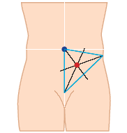 Stomamarkierung